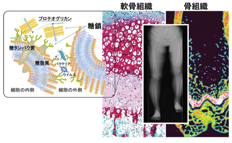 早期変形性関節症（OA）の病態解明