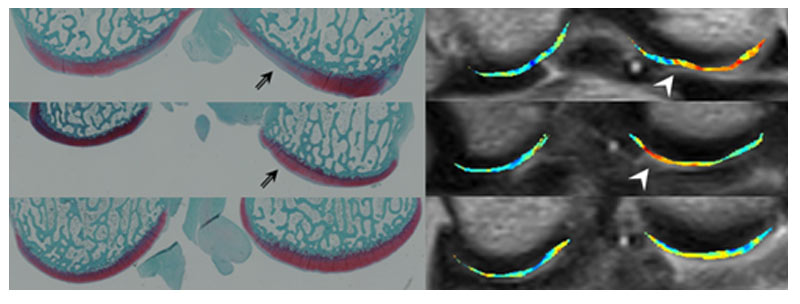 ウサギ大腿骨膝関節面 軟骨損傷部（左図 矢印）に一致してMRIでの信号変化（右図 矢印）が認められる。
