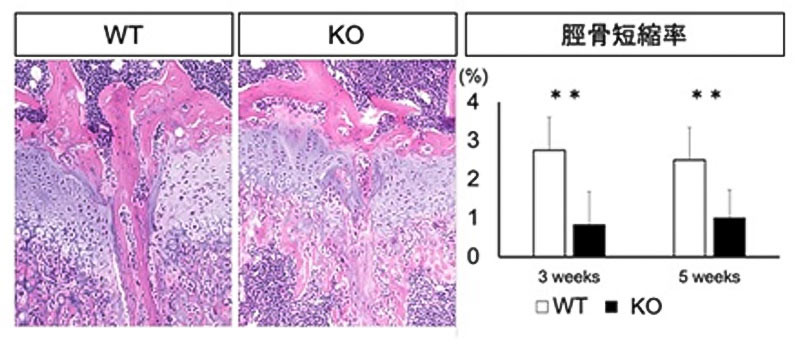 （左）マウス脛骨近位骨端線損傷後の野生型マウスとノックアウトマウスの組織学的解析。ノックアウトマウスでは損傷部の骨橋形成が阻害される。（右）脛骨短縮率。ノックアウトマウスでは変形治癒が予防される。