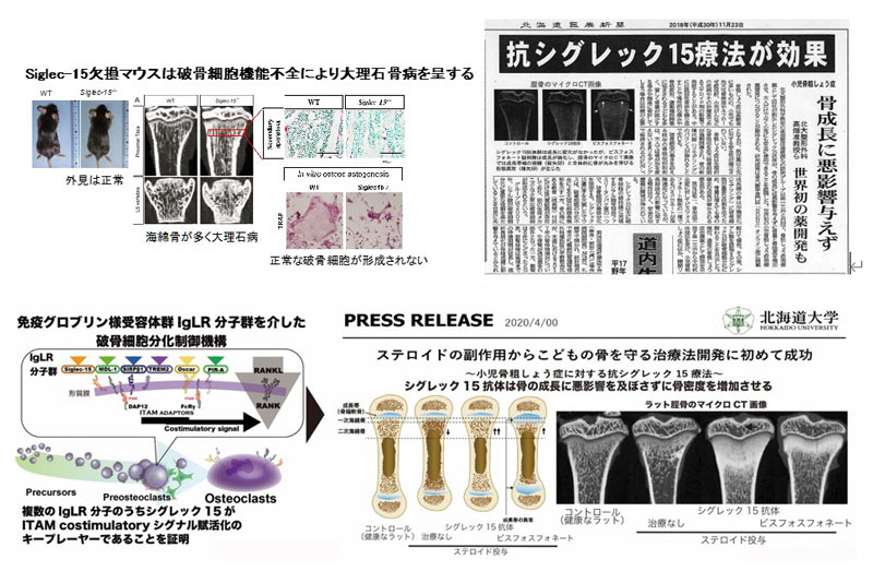 破骨細胞の最終分化制御因子Siglec-15の発見とその機能解析、治療応用研究