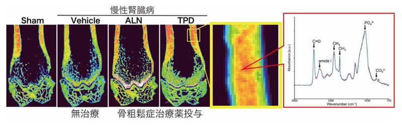 ラマン分光イメージングを用いた慢性腎臓病モデルラット大腿骨の骨質異常解析。慢性腎臓病ラットの骨は石灰化度が低下するが、Alendronate (ALN)やTeriparatide(TPD)を投与すると改善する。