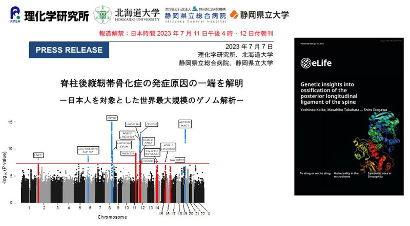 脊柱靭帯骨化症の発症に関与する８つの新規遺伝子座を発見