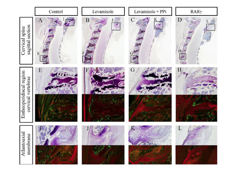 ENPP1 ttw/ttwマウスを用いた研究で、ピロリン酸を増加させるALP阻害薬LevamisoleやRARγ選択的アゴニストは異所性骨化・石灰化を抑制できることを示したが、同時に全身骨の骨軟化症が生じる可能性があることを報告した。