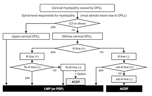 頚椎後縦靱帯骨化症に対する術式アルゴリズム